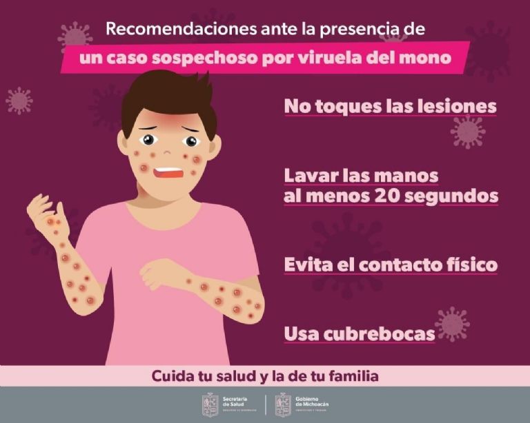 SSM emite recomendaciones ante la viruela del mono tras confirmar su primer caso. Foto: Twitter