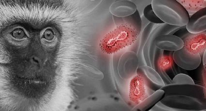 En la CDMX se concentra más del 50% de los casos de viruela de mono registrados en México