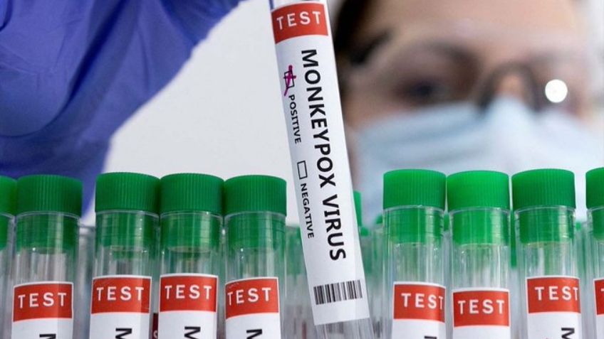 Alarmante: Casos de viruela del mono en el mundo se incrementan en 20% en la última semana