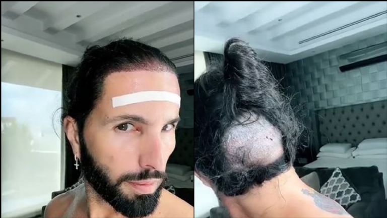 Poncho de Nigris se queda sin cabello