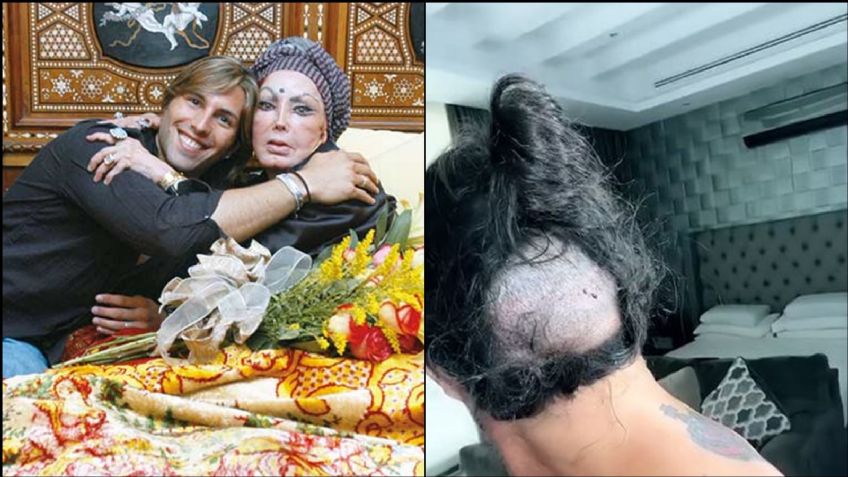 Tras 'amorío' con la Tigresa, famoso aparece con problemas de salud y dura pérdida de cabello
