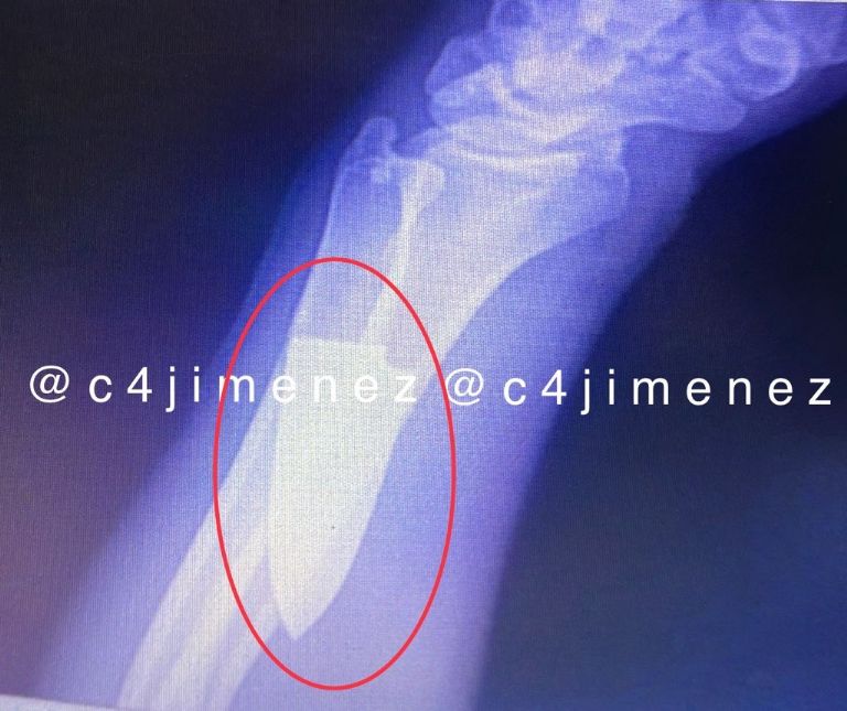 Agresión en la estación Jamaica