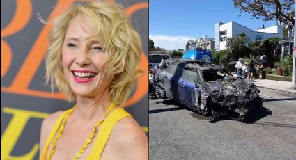 Shock en Hollywood: Tras severo choque, actriz entra en coma y la reportan con daño pulmonar