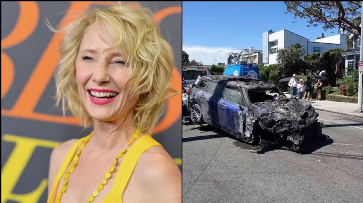 Shock en Hollywood: Tras severo choque, actriz entra en coma y la reportan con daño pulmonar