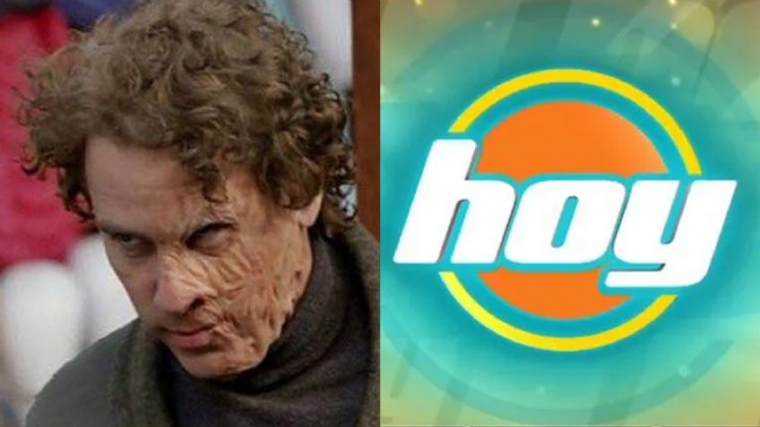Se desfiguró: Tras dejar México y retirarse de las novelas, villano de Televisa aparece en 'Hoy'