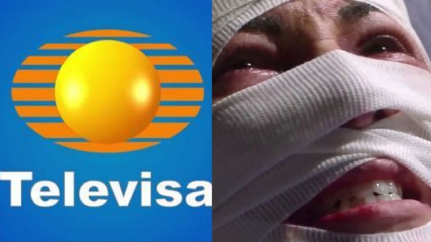 Adiós TV Azteca: Tras 18 años desaparecida y acabar desfigurada, actriz de novelas vuelve a Televisa