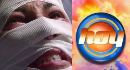 Adiós TV Azteca: Tras divorcio y retiro de Televisa, actriz llega a 'Hoy' desfigurada y en la ruina
