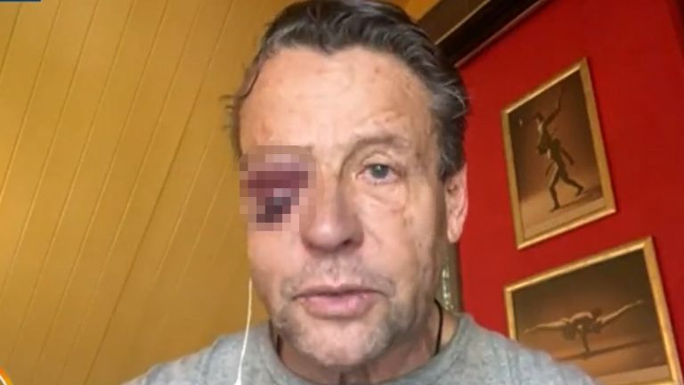 Fotografía de Alfredo Adame herido