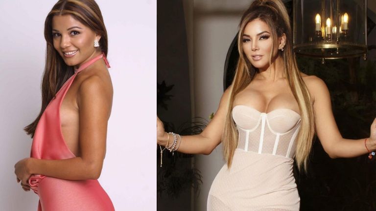 Antes y después de Aleida Nuñez