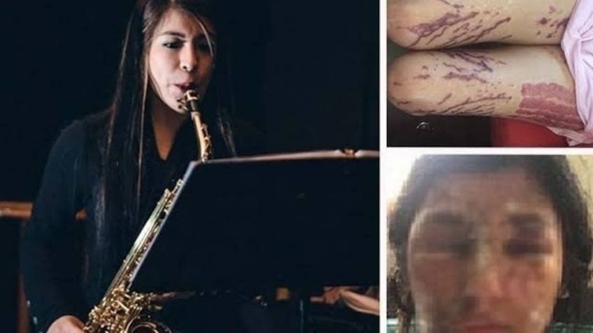 AMLO: Hombre que ordenó ataque con ácido a la saxofonista María Elena Ríos seguirá en prisión