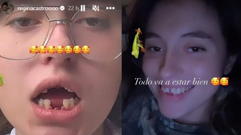 Regina Castro acabó sin dientes tras sufrir un accidente