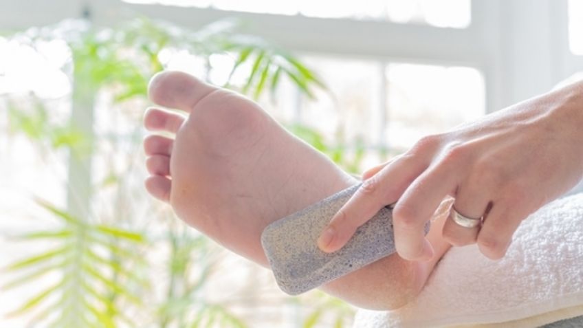 Elimina de una vez los callos en los pies con bicarbonato de sodio; paso a paso para lograrlo