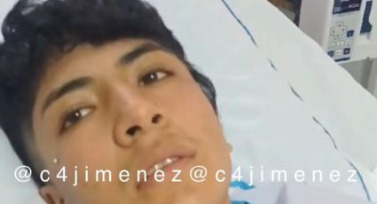 Reportan grave a Cristian, joven agredido con gasolina e incendiado en Texcoco