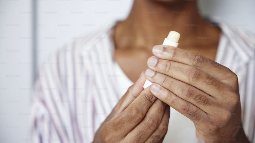 He aquí por qué tus labios están secos incluso después de usar un bálsamo, según un dermatólogo