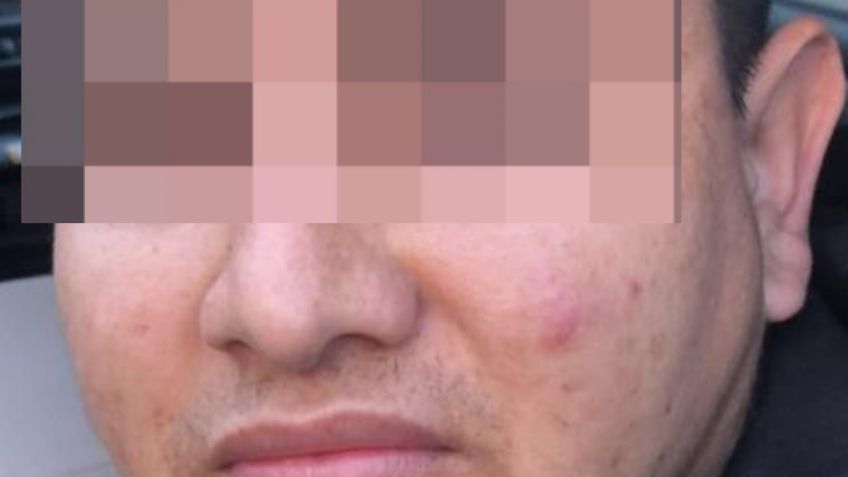 Detienen y vinculan a proceso a Bryan Ricardo 'N' por tentativa de homicidio en SLRC