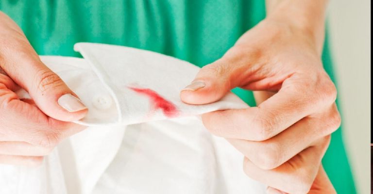 Las manchas de labial pueden ser difíciles de quitar