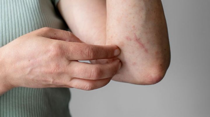 Detectan brote de fiebre maculosa transmitida por garrapatas y levanta alerta en E.U. y la frontera