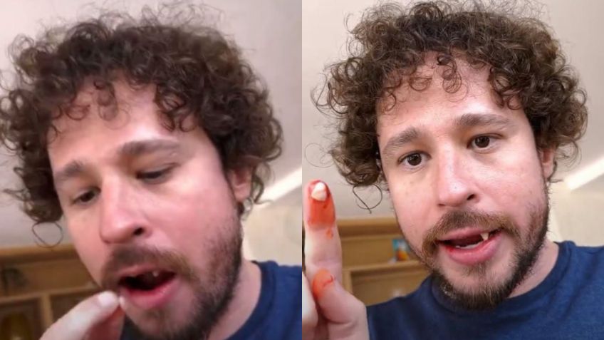 Luisito Comunica pierde los dientes en plena transmisión en vivo y lo convierten en meme