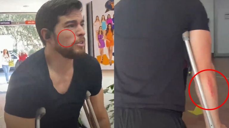 Danilo fue atropellado