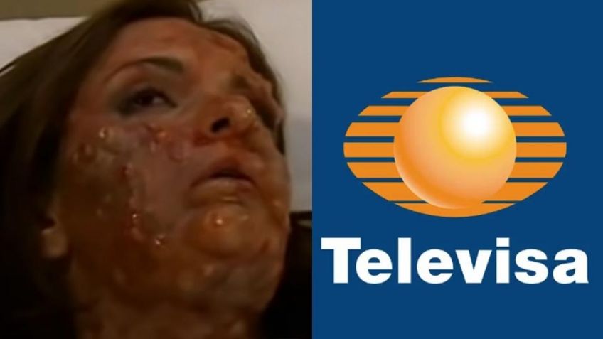 Acabó desfigurada: Tras llegar a 'VLA' y amorío con productor, villana confirma su regreso a Televisa