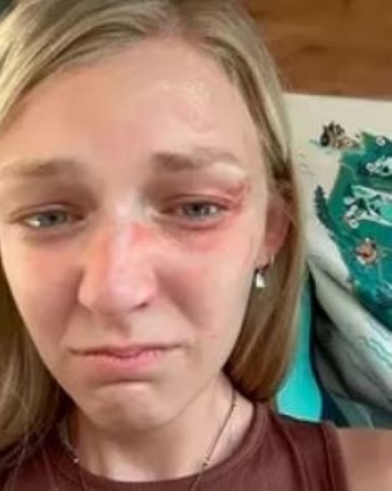 Fotografía de Gabby Petito herida