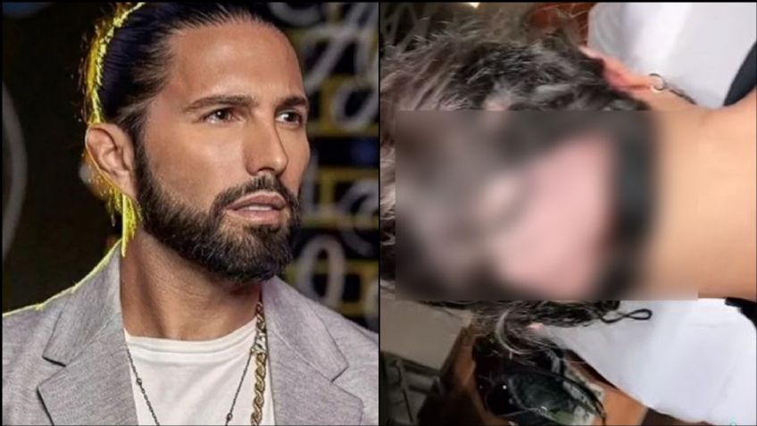 Tras sufrir pérdida de memoria y alopecia, Poncho De Nigris reaparece irreconocible en TikTok