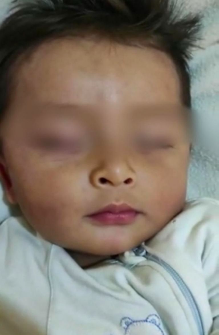 Menor de edad lesionado 