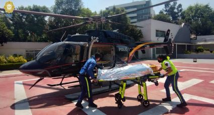 Tras electrocutarse y presentar quemaduras en el 40% del cuerpo trasladan a hombre en la CDMX