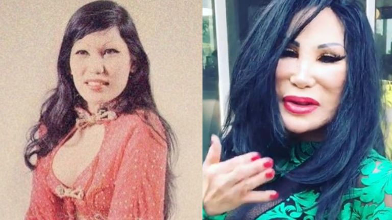 Antes y después de Lyn May