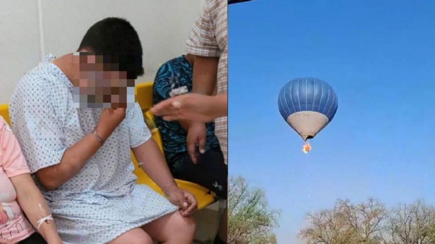 Con el cuerpo y rostro quemados: La salud de Víctor 'N', piloto del globo aerostático de Teotihuacán