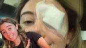 Chica termina en el hospital tras seguir consejo de belleza viral en TikTok; la tuvieron que operar