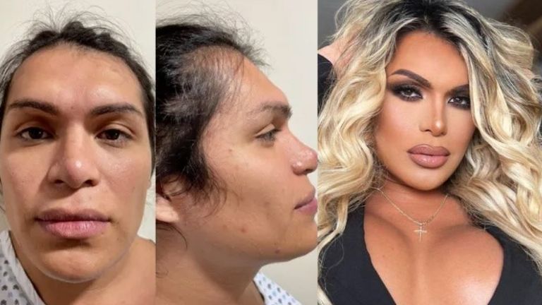 Antes y después de Wendy Guevara