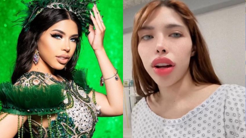 Yeri Mua alerta a sus millones de seguidores al aparecer desde el hospital, ¿qué tiene?