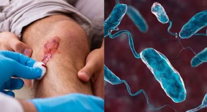 ¿Ya está en México? Alertan sobre Vibrio vulnificus, bacteria come carne en el mar caribe