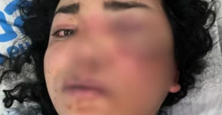 Paolita Suárez tras ser agredida por su expareja