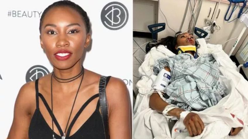 Tragedia en Marvel: Arrollan a actriz de 'Black Panther'; se encuentra grave en el hospital