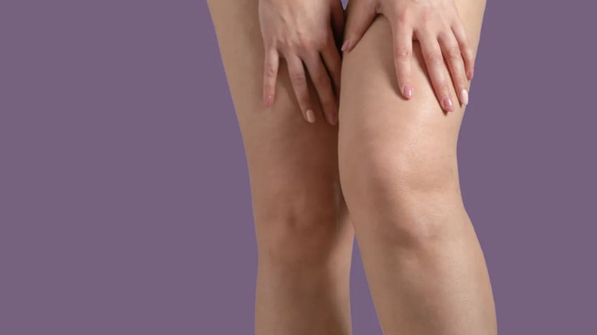 Celulitis, piernas pesadas: Alimentos para combatir la retención de líquidos