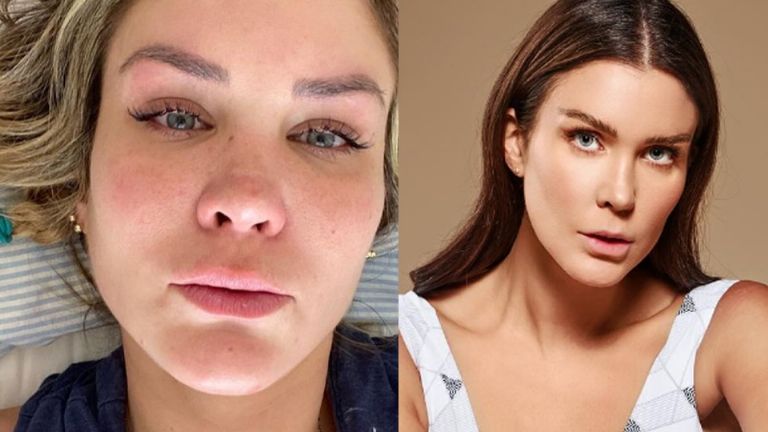 El rostro de Verónica Montes cambia por su desbalance hormonal