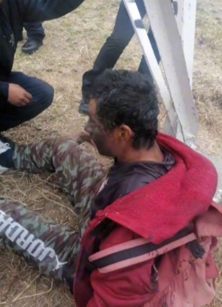 El rostro del masculino lucía totalmente negro