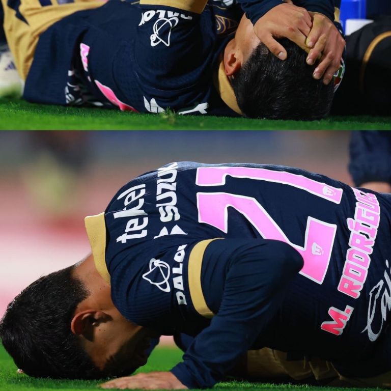 Pumas confirma lesión ante Cruz Azul