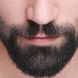 Francia: Se hace un injerto de barba y termina con graves secuelas; decide acabar con su vida