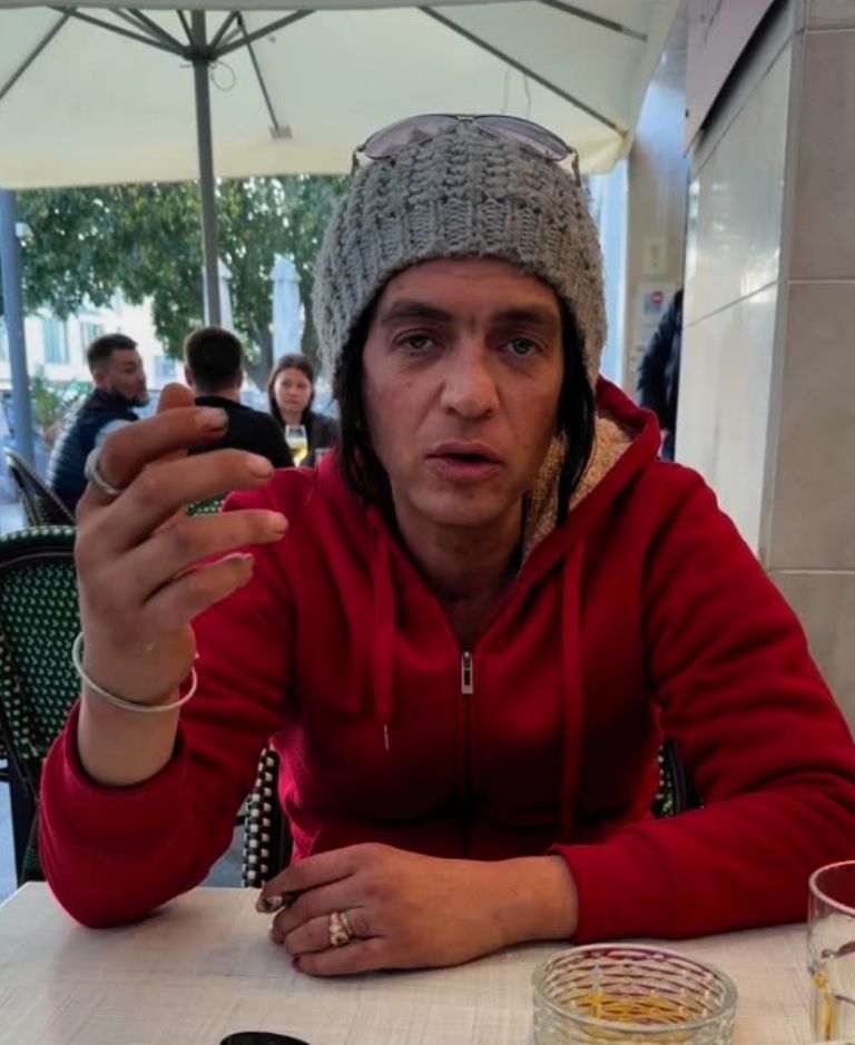 Creen que la hinchazón de manos se debe al abuso de drogas