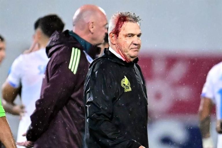 Aguirre termina lesionado en Honduras