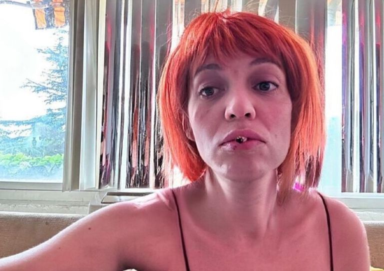 Camilo Blanes alerta a fans con nueva foto