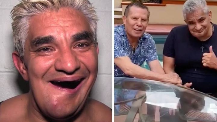 Esto necesita Shocker para reconstruir su mandíbula; Julio César Chávez lo apoyaría