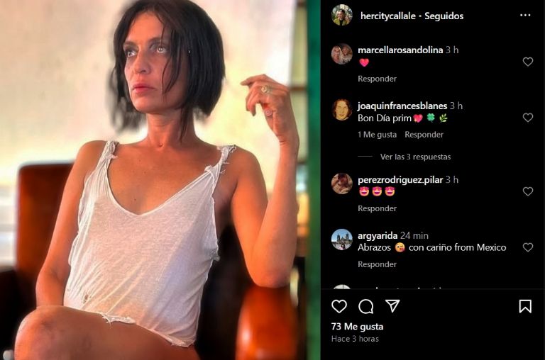 Hijo de Camilo Sesto reaparece con heridas en las piernas