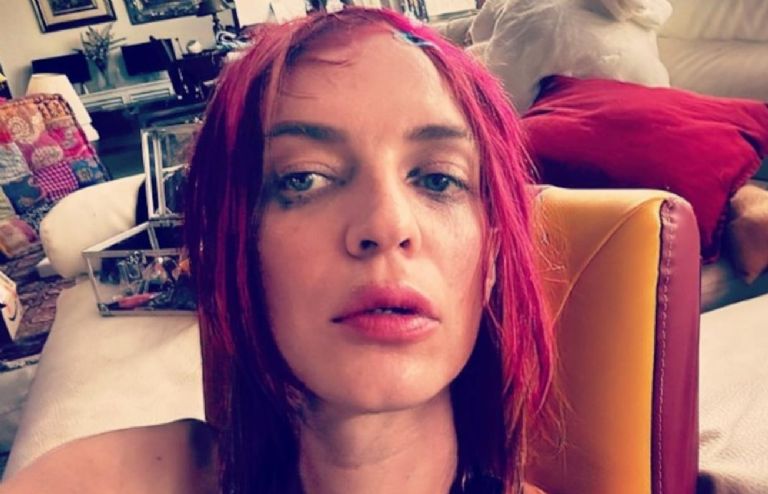 Hijo de Camilo Sesto comparte FOTO de incendio