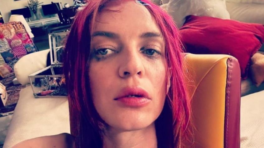 Hijo de Camilo Sesto vuelve a paralizar las redes sociales tras posar 'herido' en una FOTO