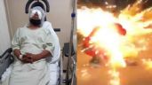 Foto ilustrativa de la nota titulada Disfrazado de Santa Claus, Miguel pierde un ojo en explosión de pirotecnia, en Coahuila