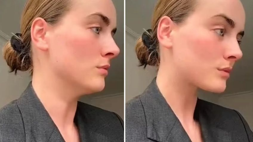 Mewing: ¿qué es esta técnica para reducir la papada de forma natural y realmente funciona?